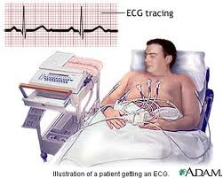 الکتروکاردیوگرام (به انگلیسی: Electrocardiogram)‏ یا نوار قلب